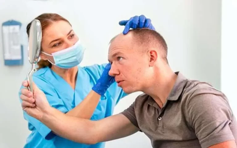 ترمیم مو به روش مایکروپوینت