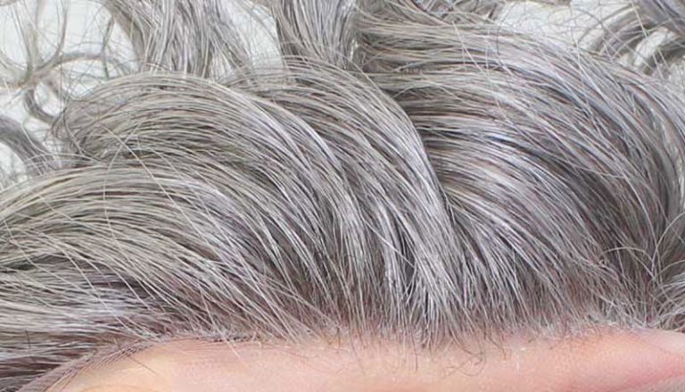 پروتز مو سیلیکونی