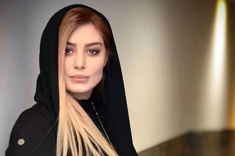 کاشت ابرو بازیگران