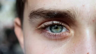 کاشت ابرو روی اسکار